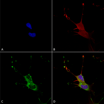 LGI1 Antibody (Biotin)