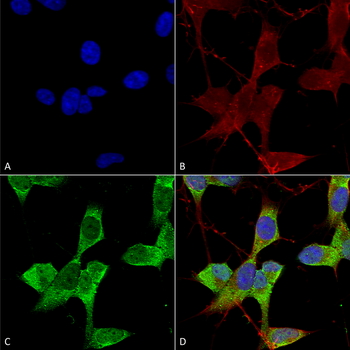 KCNK3 Antibody (Biotin)