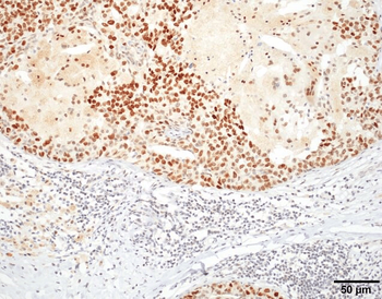 HSF1 Antibody (APC)