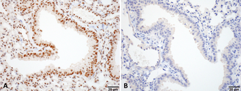 HSF1 Antibody (APC)