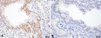 HSF1 Antibody (APC)