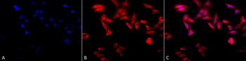 TCP1 alpha Antibody