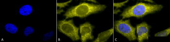 TCP1 alpha Antibody (RPE)