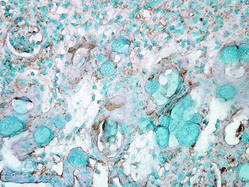 HSP70 Antibody (HRP)