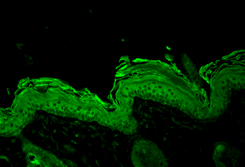 HSP90 Antibody (Biotin)