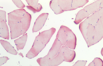 HSP27 Antibody (RPE)
