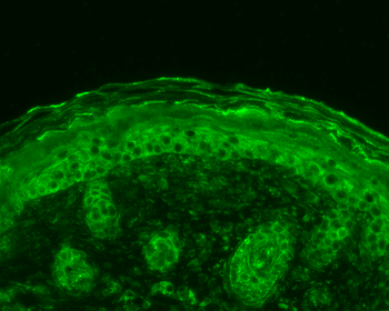 Calnexin-CT Antibody (FITC)