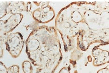 SOD1 (Cu/Zn) Antibody (HRP)