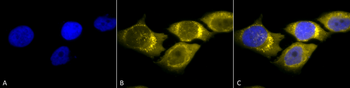 SOD2 (Mn) Antibody (FITC)