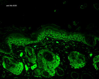 SOD2 (Mn) Antibody (HRP)