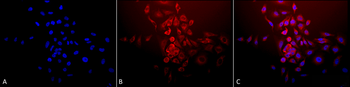 SOD2 (Mn) Antibody (HRP)