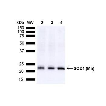 SOD2 (Mn) Antibody (FITC)