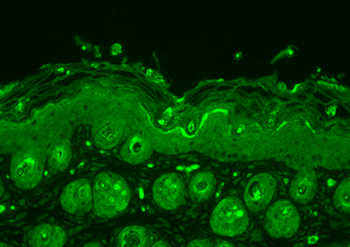 Ubiquitin Antibody (FITC)
