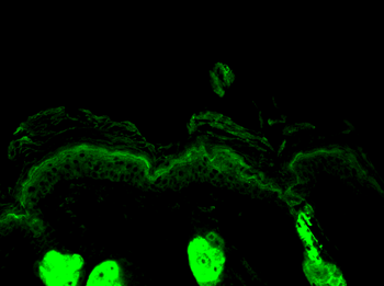 Calreticulin Antibody (RPE)