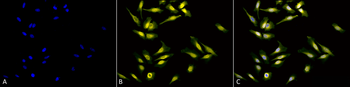 Calreticulin Antibody (RPE)