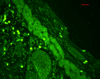 Rab4 Antibody (HRP)