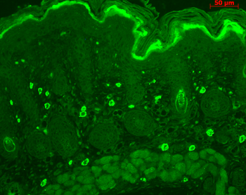 TNF-R1 Antibody (HRP)