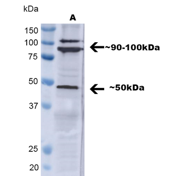 TNF-R1 Antibody (HRP)