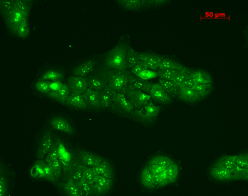 TNF-R1 Antibody (HRP)