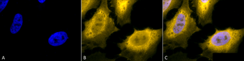 HSP70 Antibody (RPE)