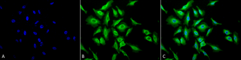 HSP70 Antibody (RPE)