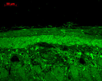 HSP22 Antibody (FITC)