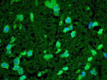 HSP22 Antibody (PerCP)