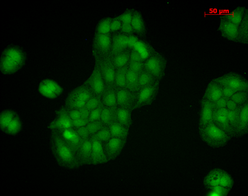 Calnexin-CT Antibody (HRP)