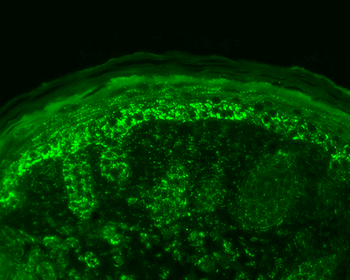 Cpn10 Antibody (HRP)