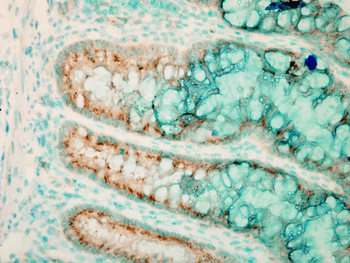 TLR4 Antibody (HRP)