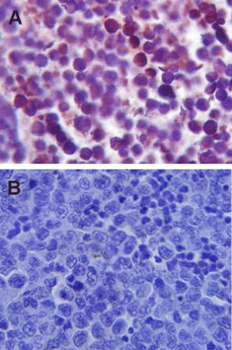 TLR4 Antibody (RPE)