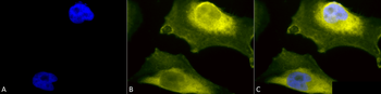 SOD1 (UbetaB) Antibody (FITC)