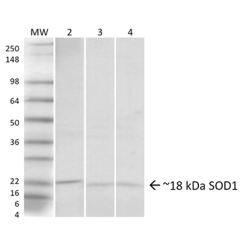 SOD1 (UbetaB) Antibody (PerCP)