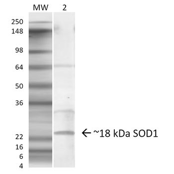 SOD1 (EDI) Antibody (FITC)