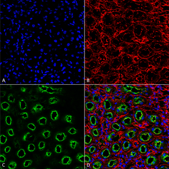 NKCC2 Antibody (APC)