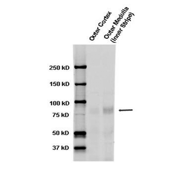 ENaC alpha Antibody (APC)