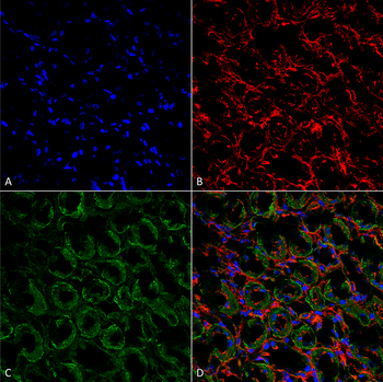 ENaC alpha Antibody (Biotin)