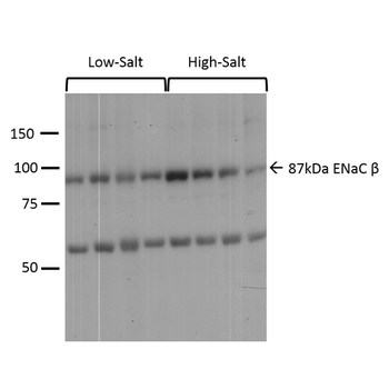 ENaC beta Antibody (HRP)