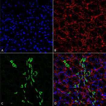 UT-A1 Antibody (Biotin)