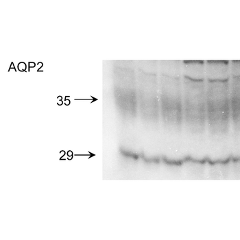 Aquaporin 2 Antibody (HRP)