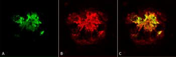 Amyloid Oligomers (A11) Antibody (HRP)