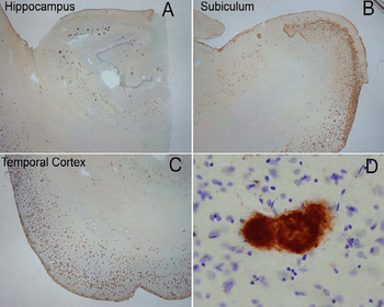 Amyloid Fibrils (OC) Antibody (FITC)