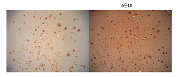 Amyloid Fibrils (OC) Antibody (HRP)