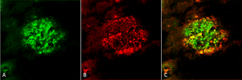 Amyloid Fibrils (OC) Antibody (PerCP)