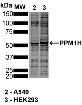 PPM1H Antibody (APC)