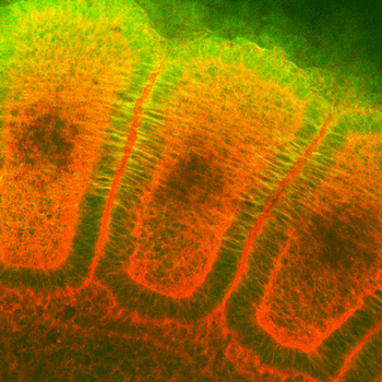 HSP27 Antibody (FITC)