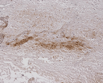 Alginate Antibody (HRP)