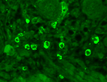 GABA A Receptor Antibody (APC)