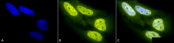 Acetylated Lysine Antibody (RPE)