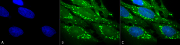 HSP60 Antibody